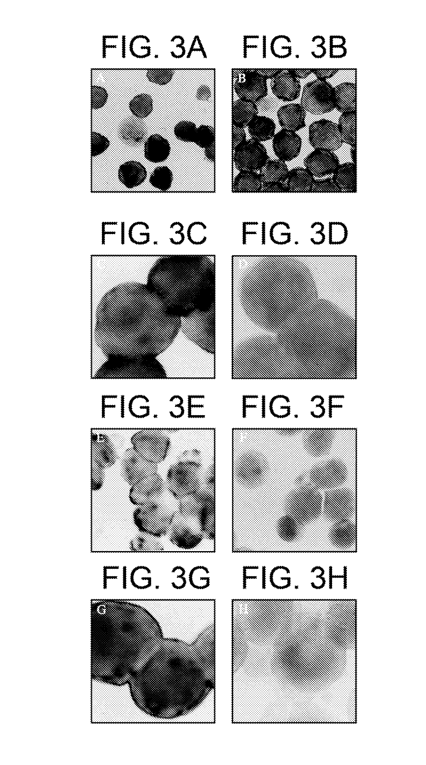 Method of inhibiting infection by HCV, other flaviviridae viruses, and any other virus that complexes to low density lipoprotein or to very low density lipoprotein in blood by preventing viral entry into a cell