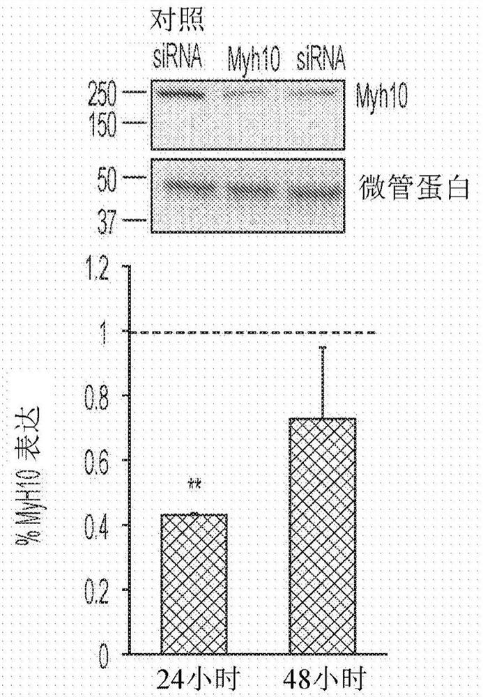 Nonmuscle myosin ii inhibitors for substance use relapse