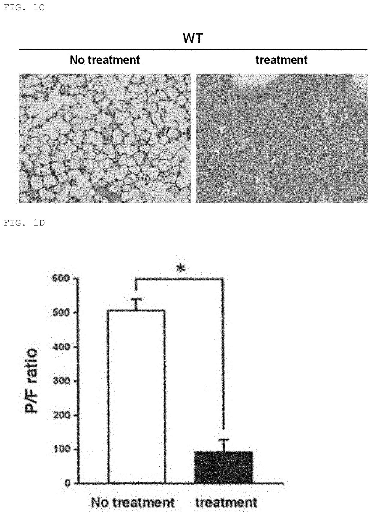 Composition For Treating Fulminant Acute Pneumonia Including CD69 Antagonist