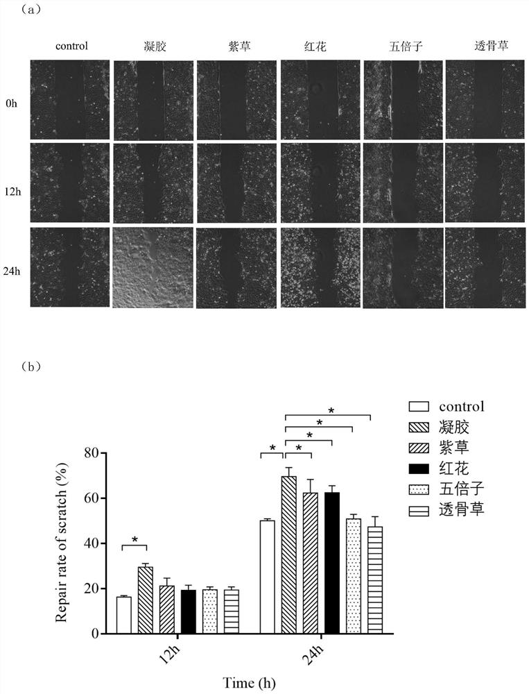 Traditional Chinese medicine composition and application thereof