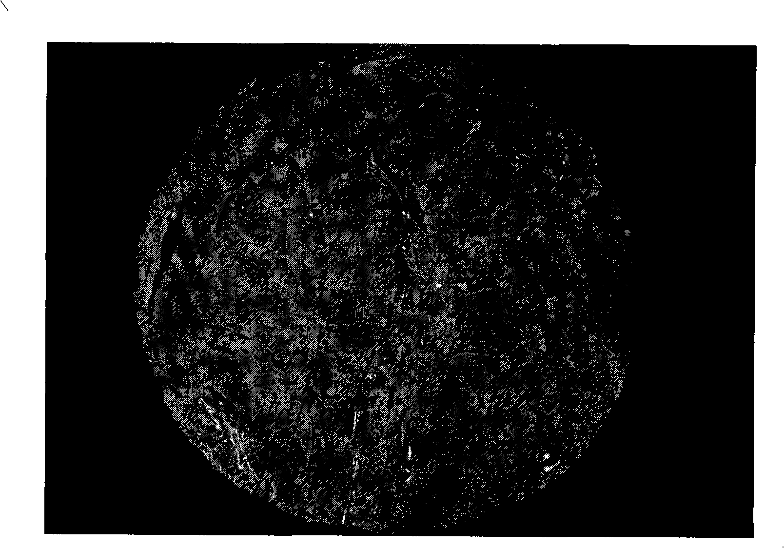 Method for detecting identical antigen expression on identical sample