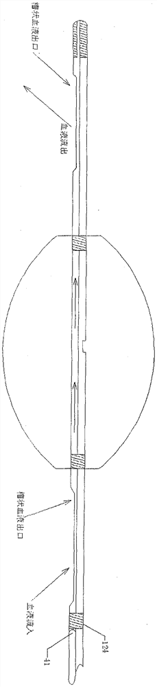 Balloon catheter capable of controlling blocking amount of blood flow