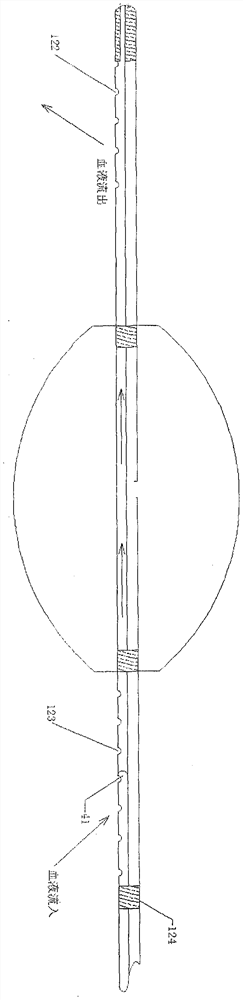 Balloon catheter capable of controlling blocking amount of blood flow