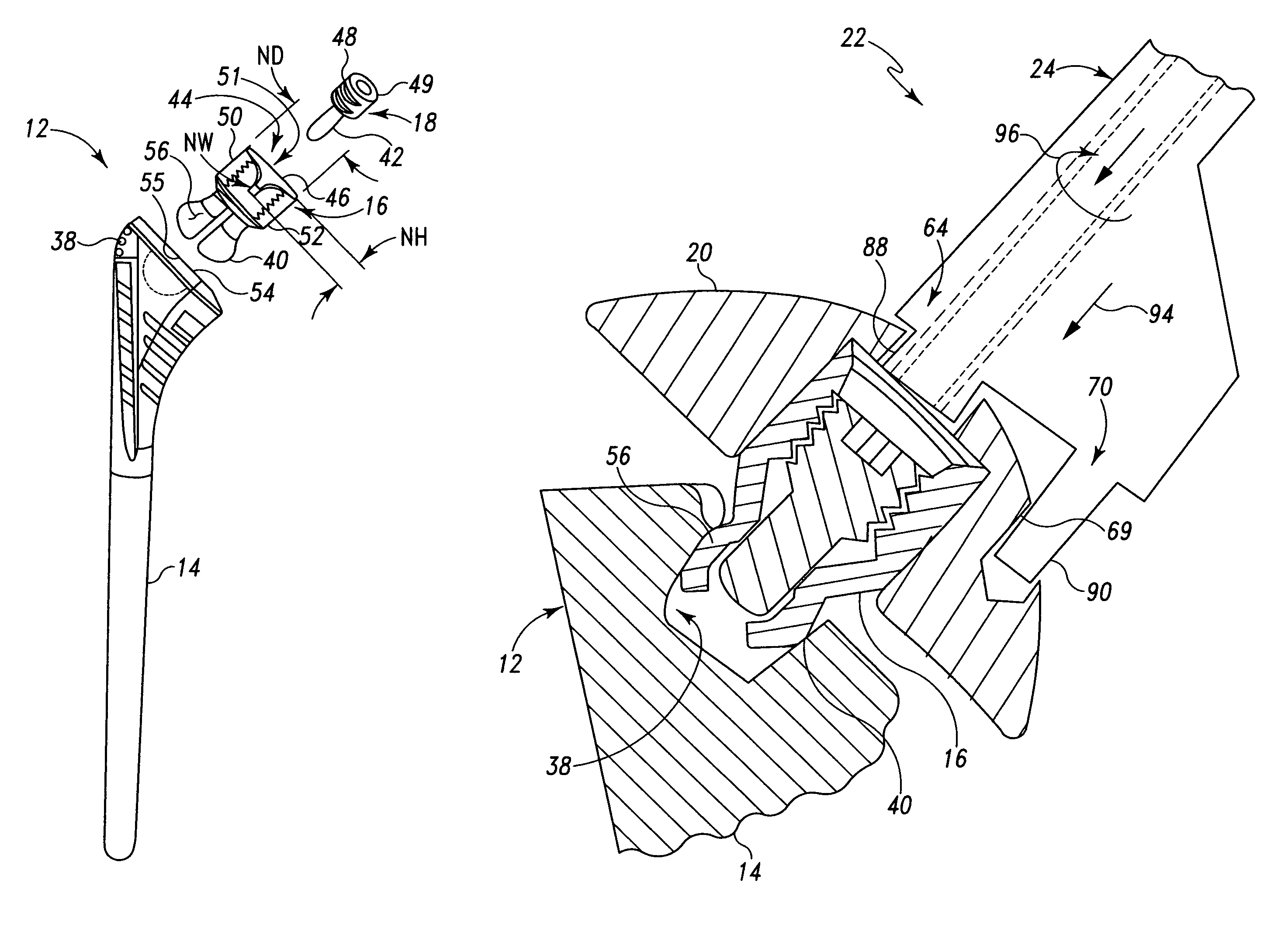 Instrument for modular orthopaedic prosthesis