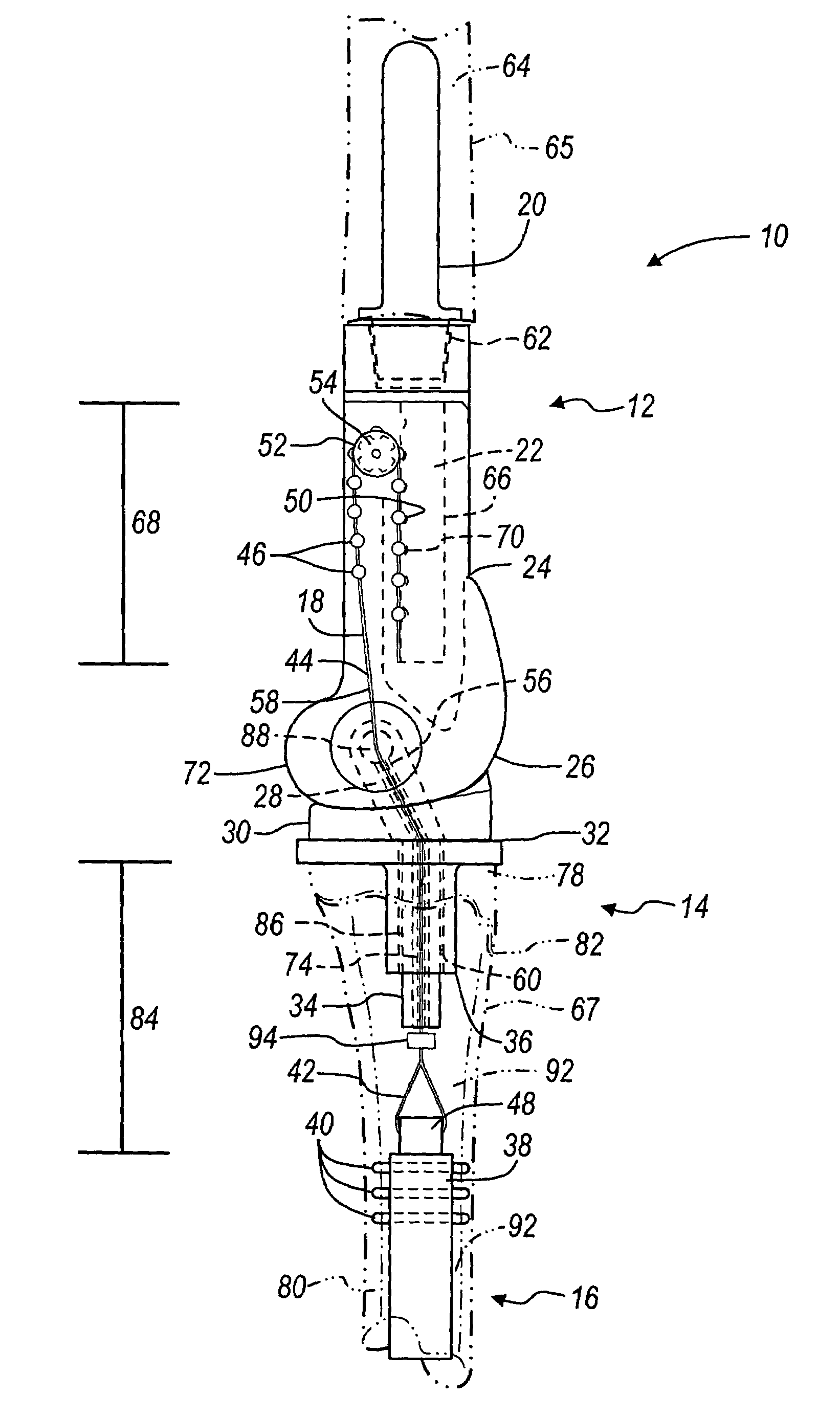 Method and apparatus for use of a non-invasive expandable implant