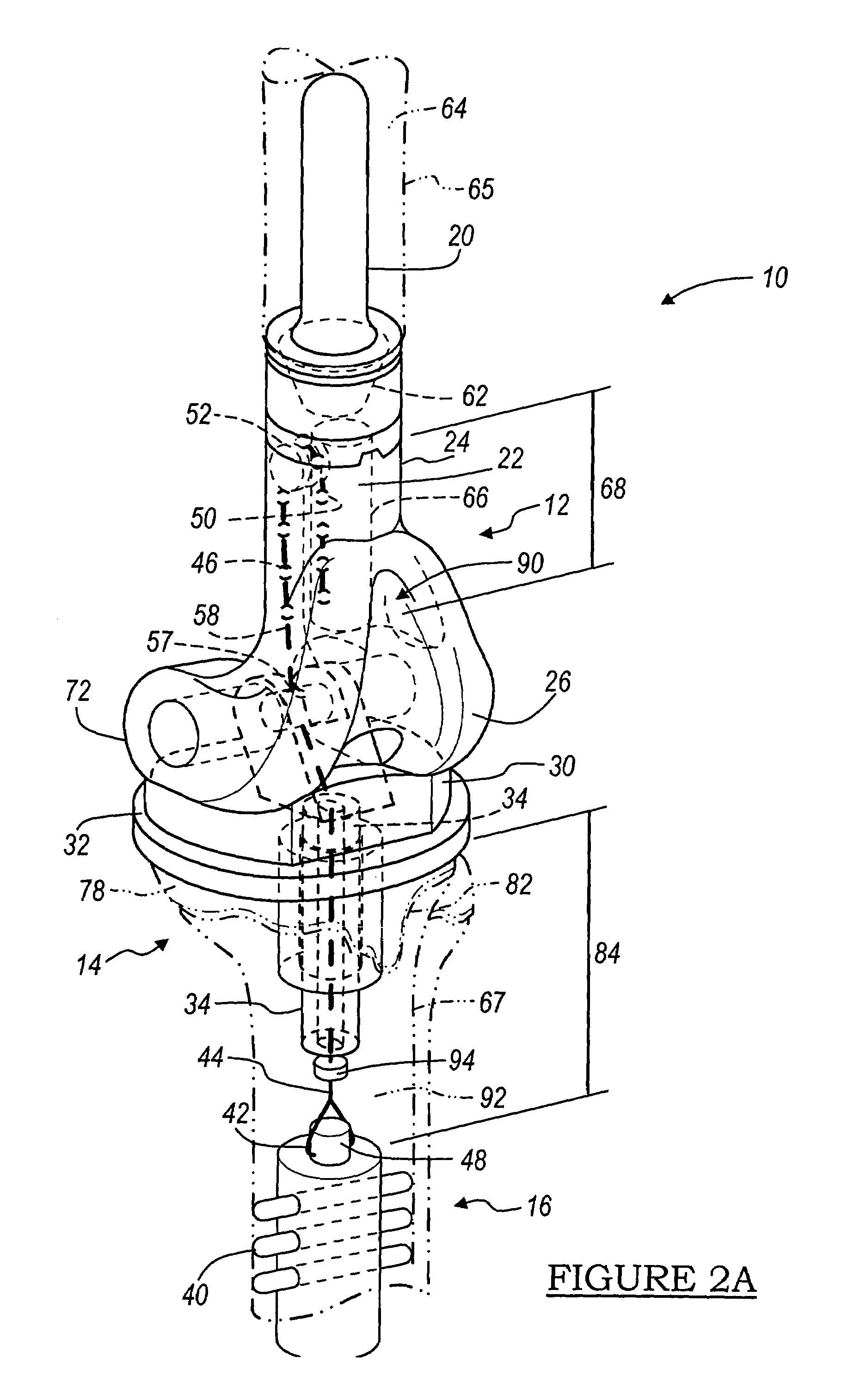 Method and apparatus for use of a non-invasive expandable implant