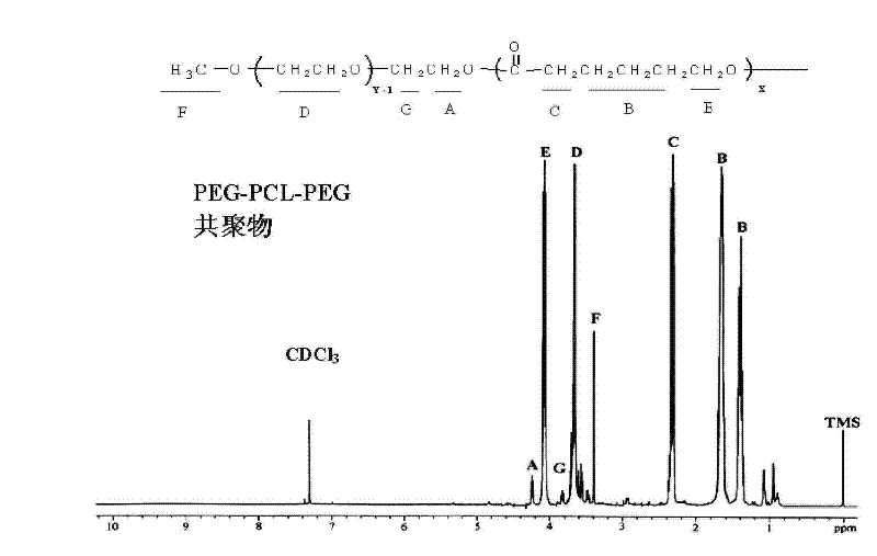 Thermo-sensitive tri-block copolymer having sol-gel conversion characteristic and preparation thereof