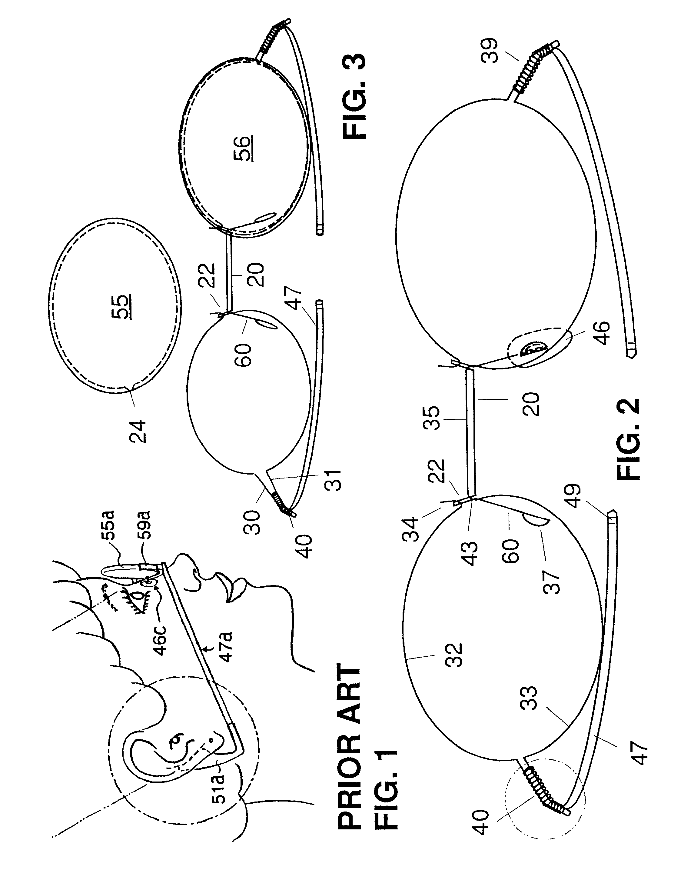 Mechanically-attached nosebridge element for eyewear frame