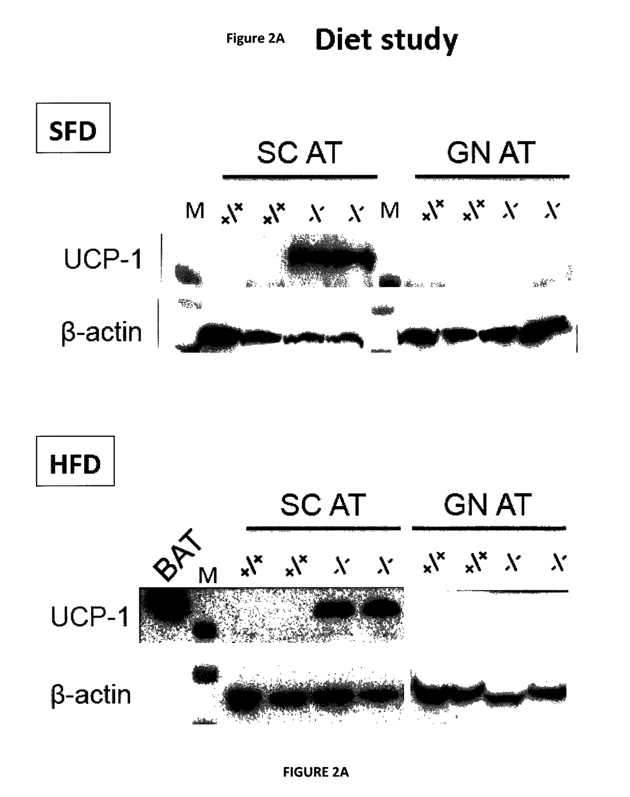 Modulating adipose tissue and adipogenesis