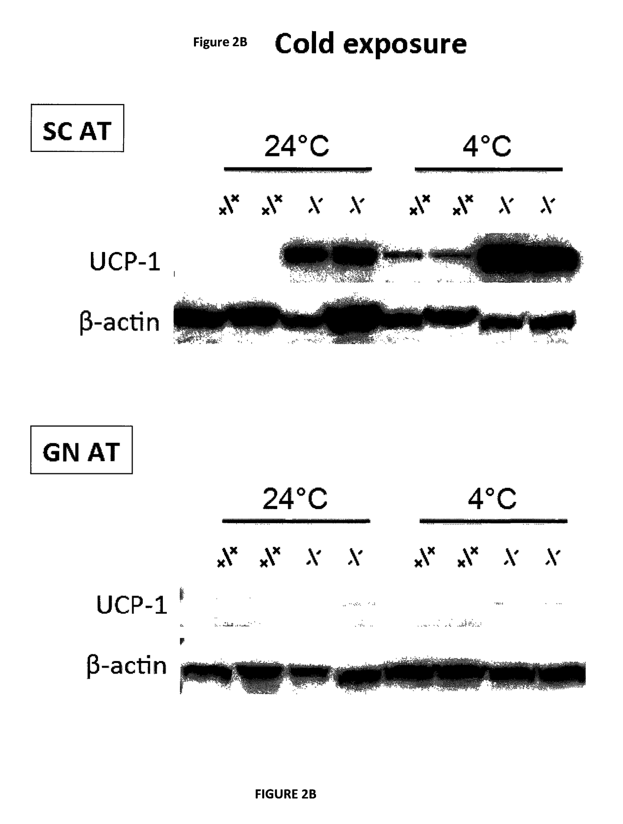 Modulating adipose tissue and adipogenesis