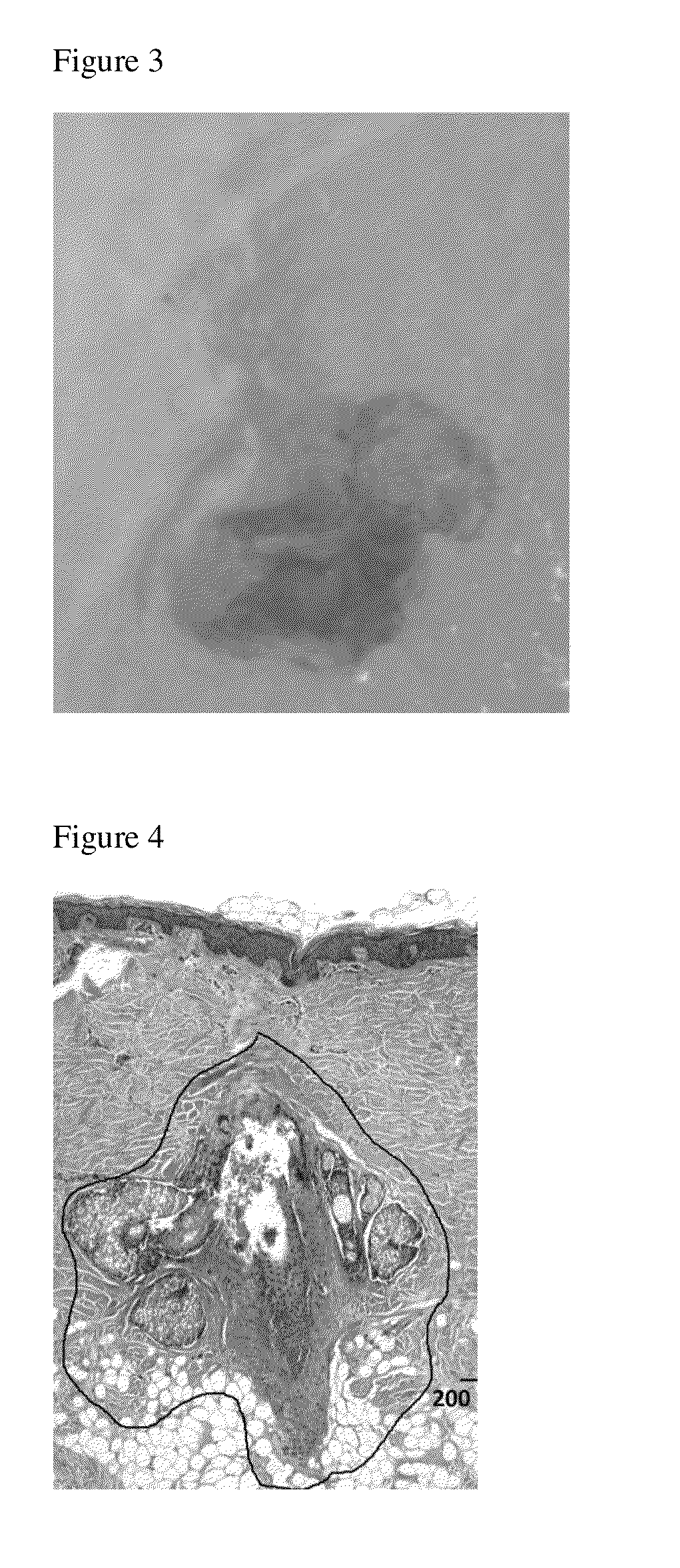 Compositions and methods comprising energy absorbing materials for follicular delivery