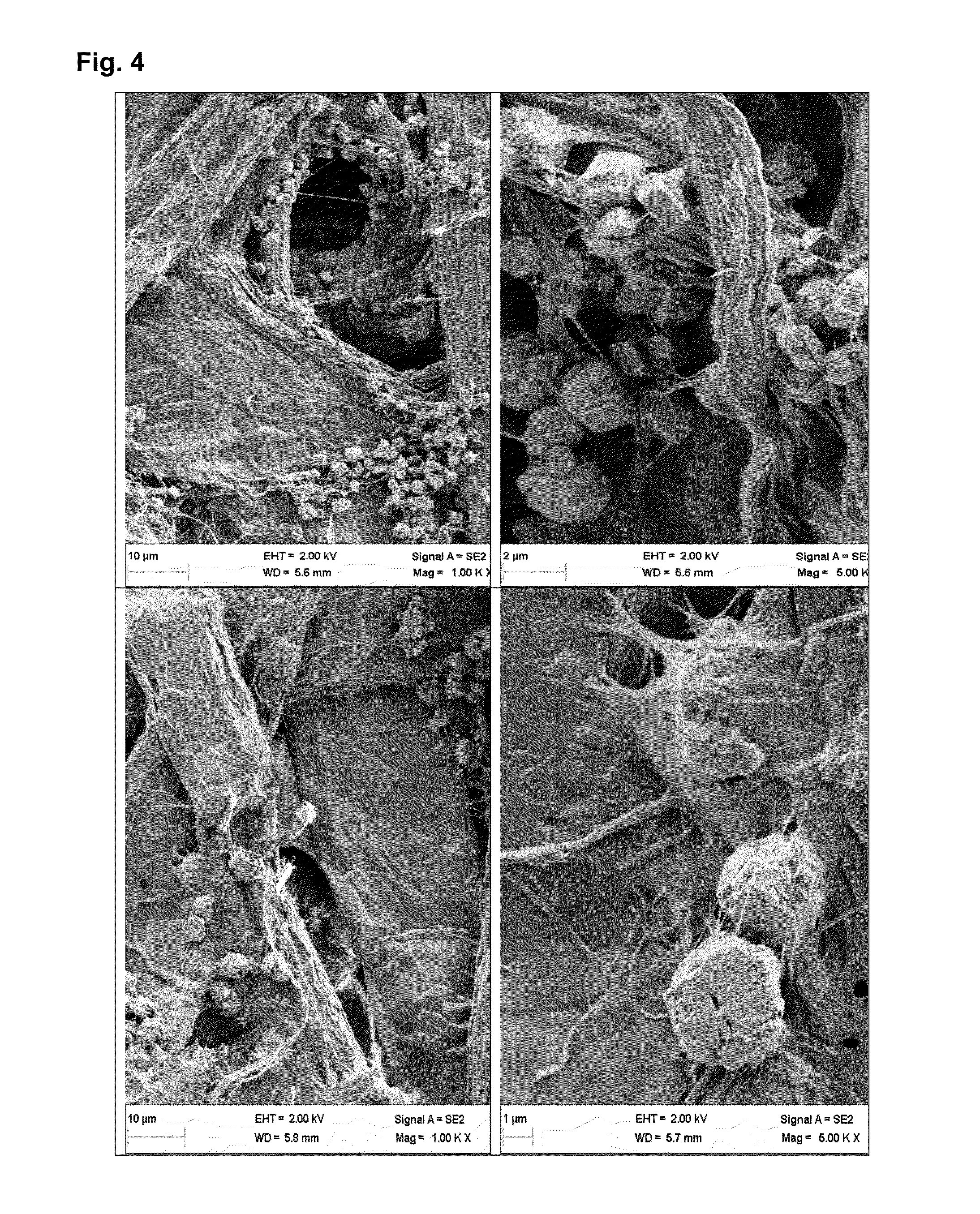 Use of precipitated carbonate in the manufacture of a fibre product