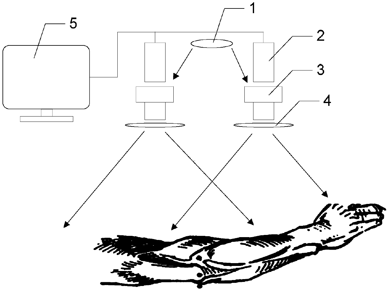 Vein vessel recognition system based on vein puncture robot