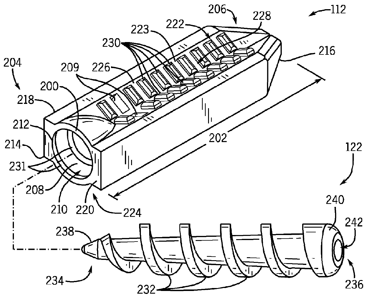 System and Method for Ligament Reconstruction