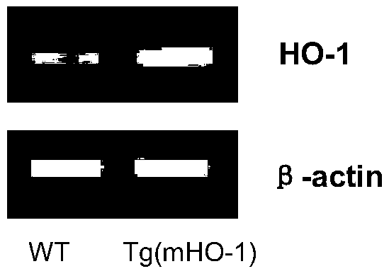 Method for generating HO-1/APP/PSEN1 triple-transgenic Alzheimer disease mouse model