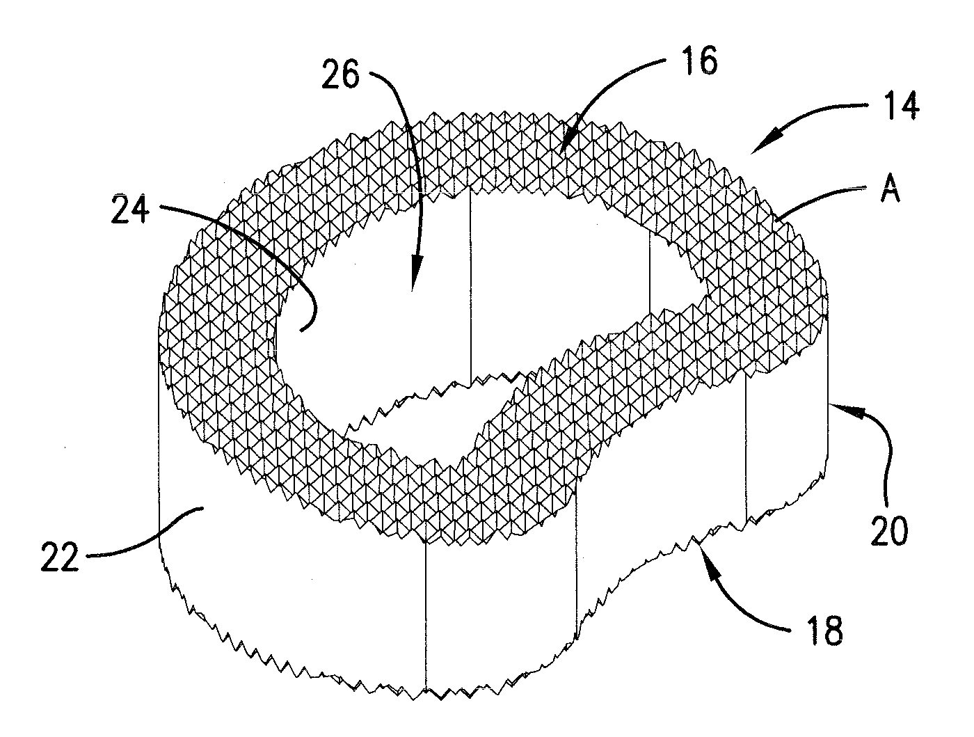 Reinforced carbon fiber/carbon foam intervertebral spine fusion device