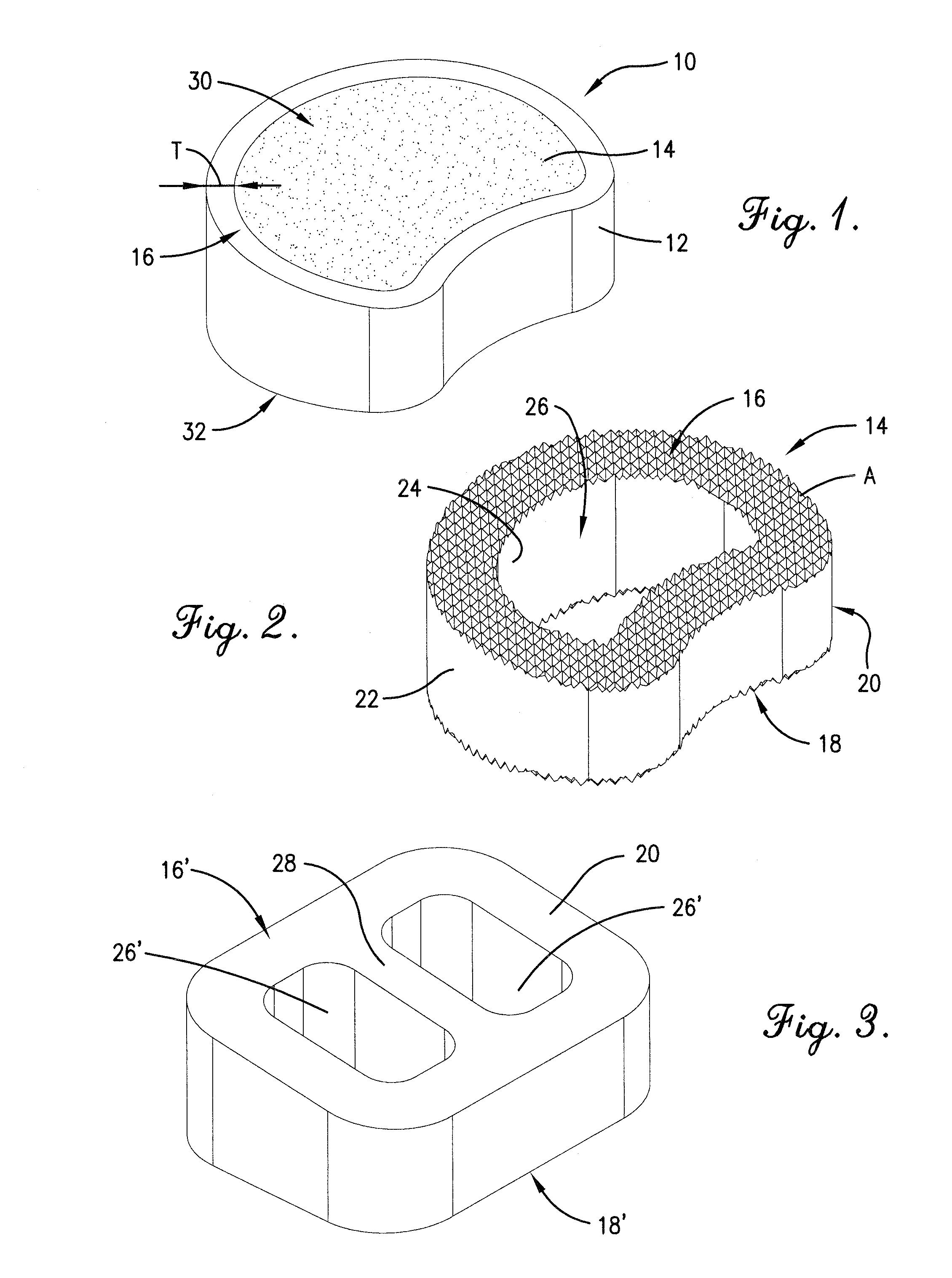 Reinforced carbon fiber/carbon foam intervertebral spine fusion device