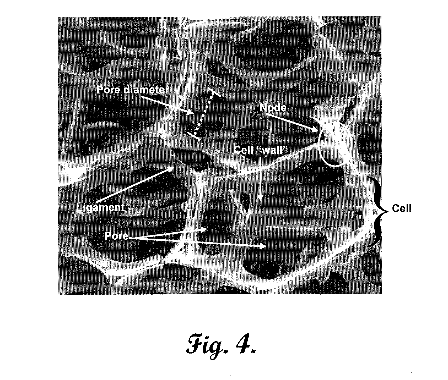 Reinforced carbon fiber/carbon foam intervertebral spine fusion device