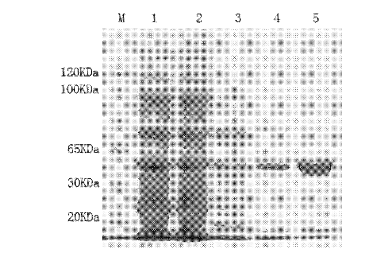 Phytoene dehydrogenase gene and application thereof