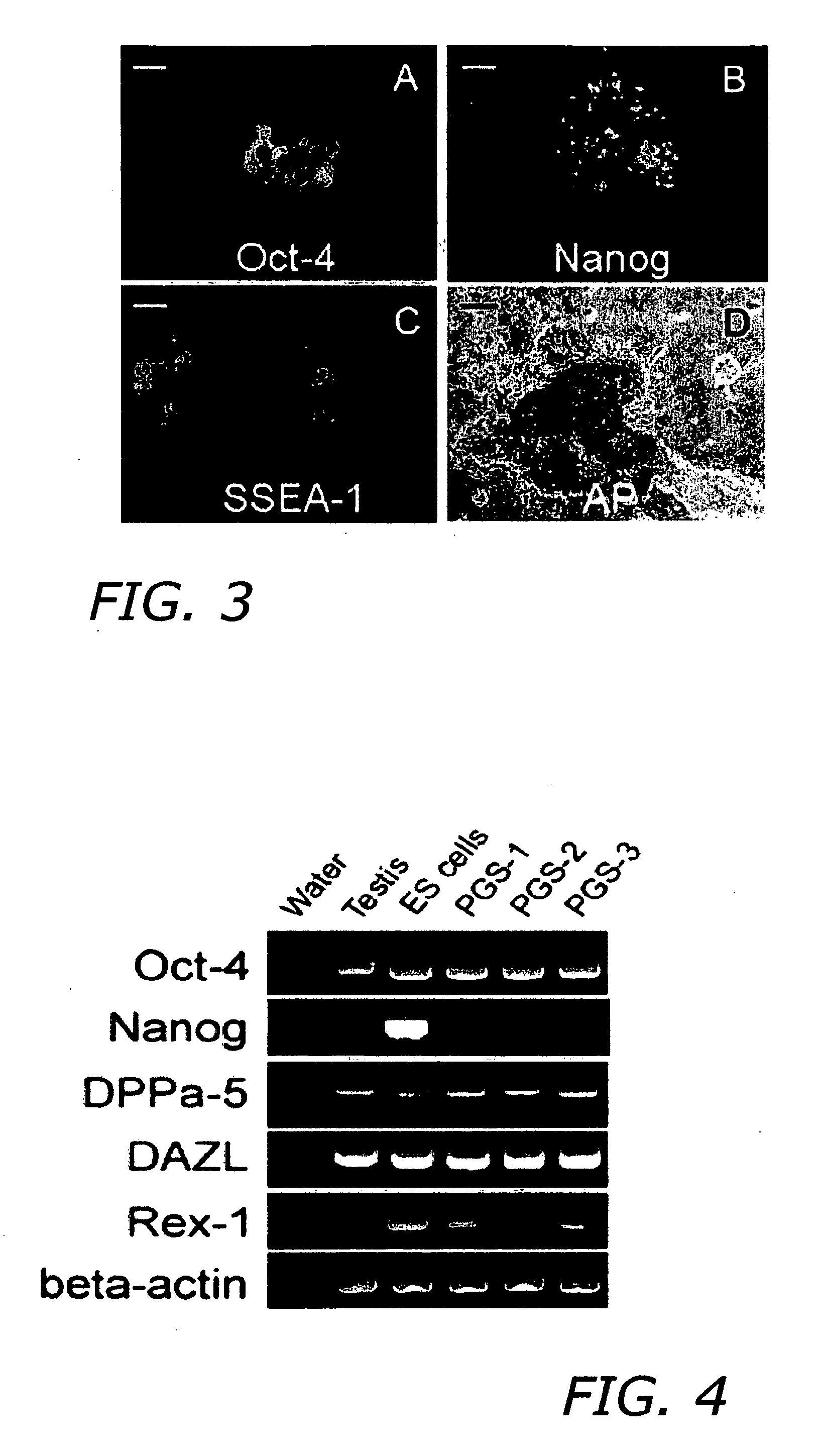 Therapeutic reprogramming of germ line stem cells