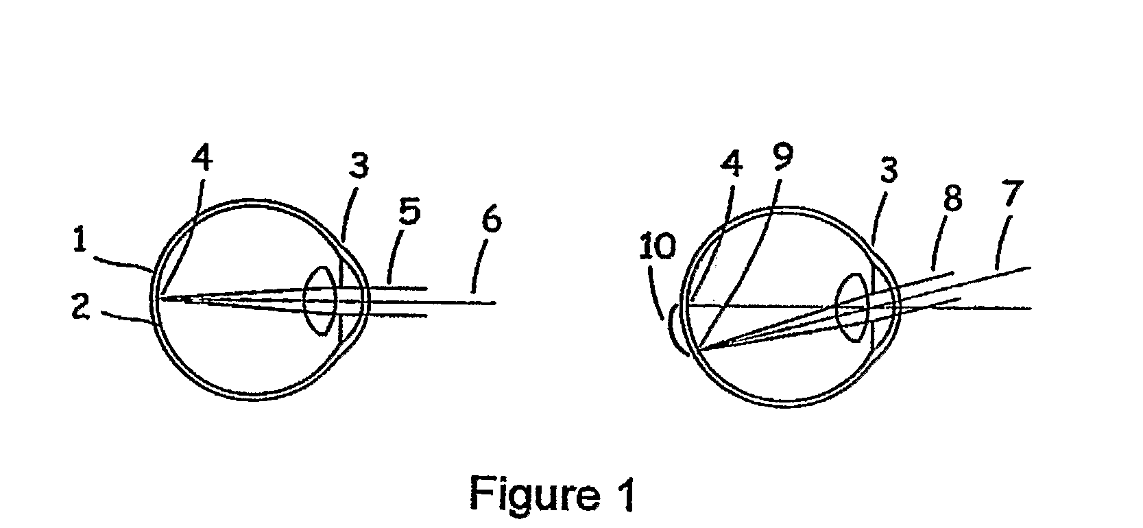 Choroid and Retinal Imaging and Treatment System