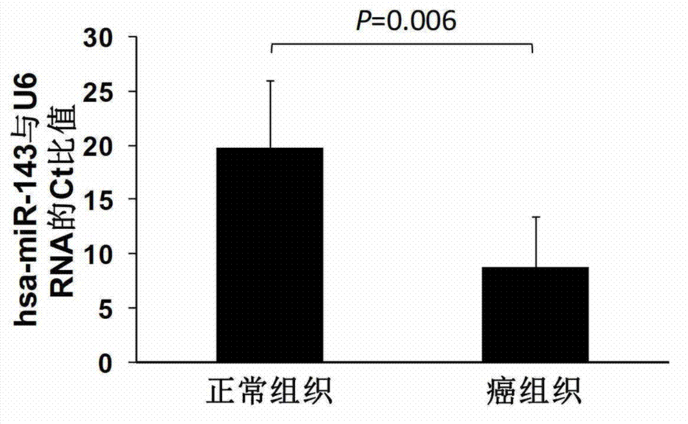 MicroRNA (micro ribonucleic acid) for regulating gene expression of B7-H4 (a molecule of the B7 family)