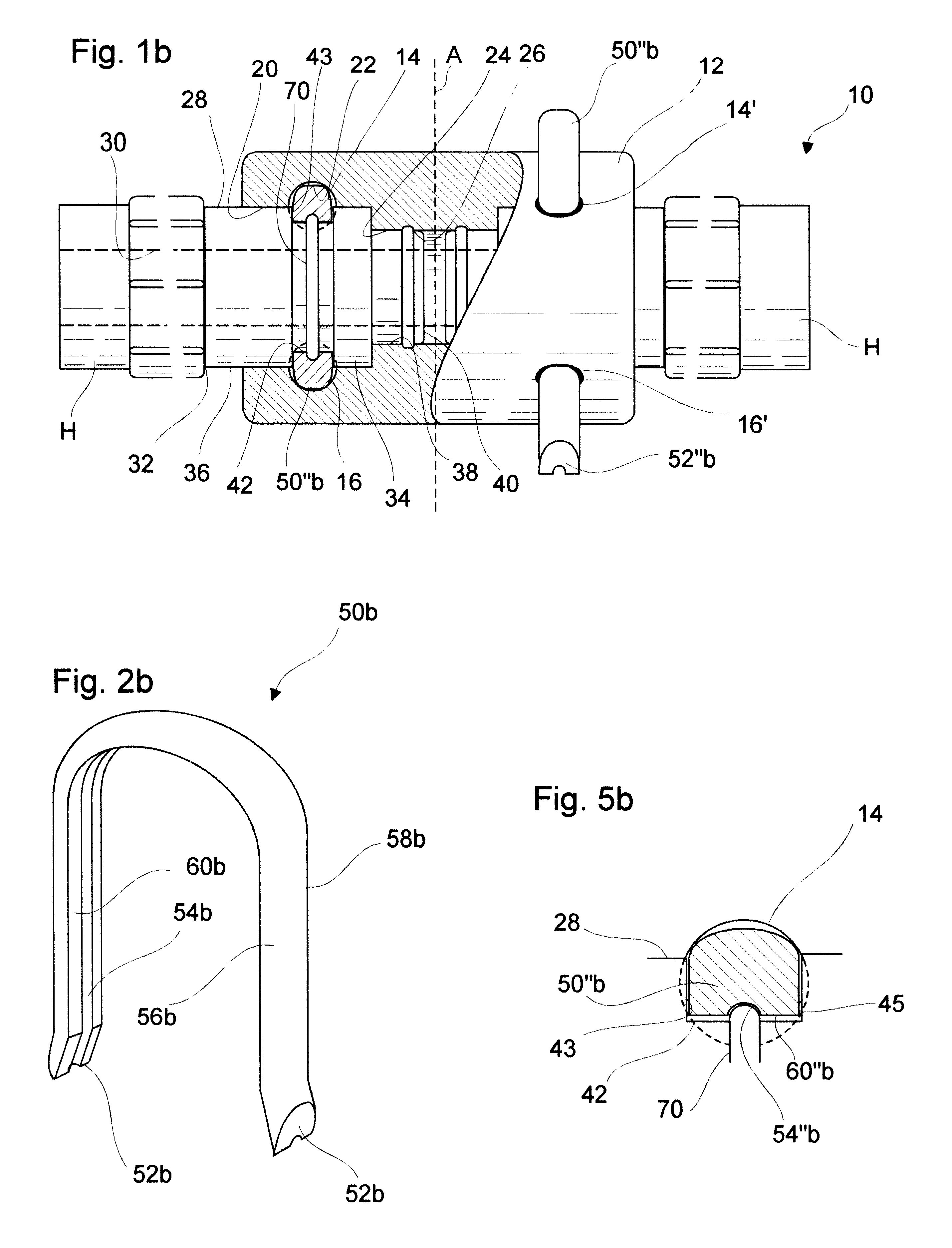 Detachable hose coupling having improved interlocking staple