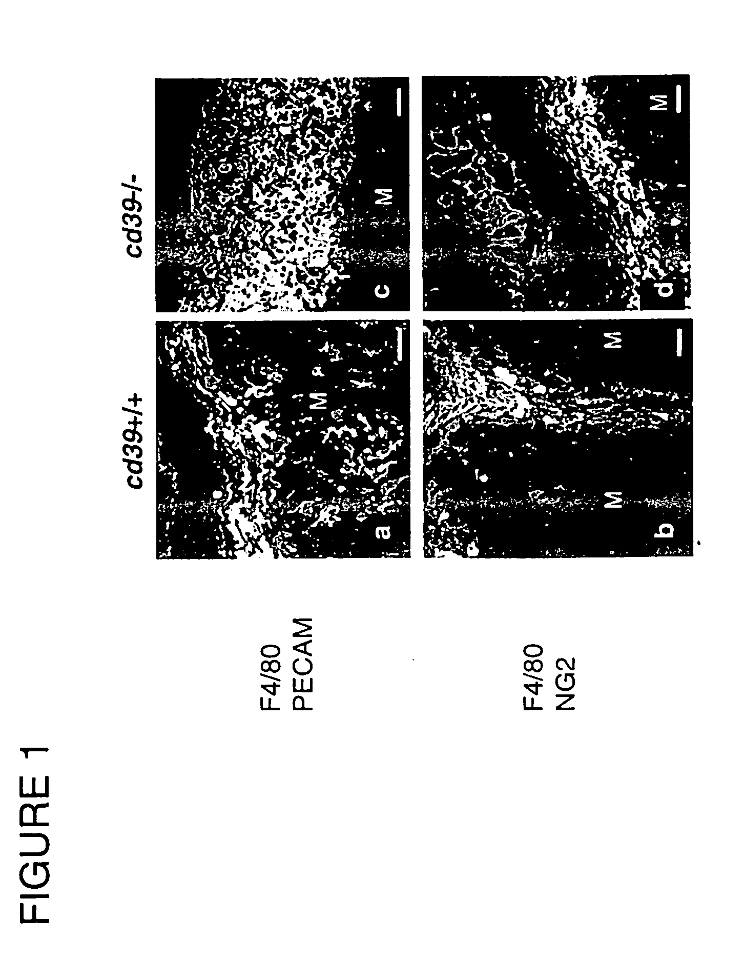 Method of reducing angiogenesis