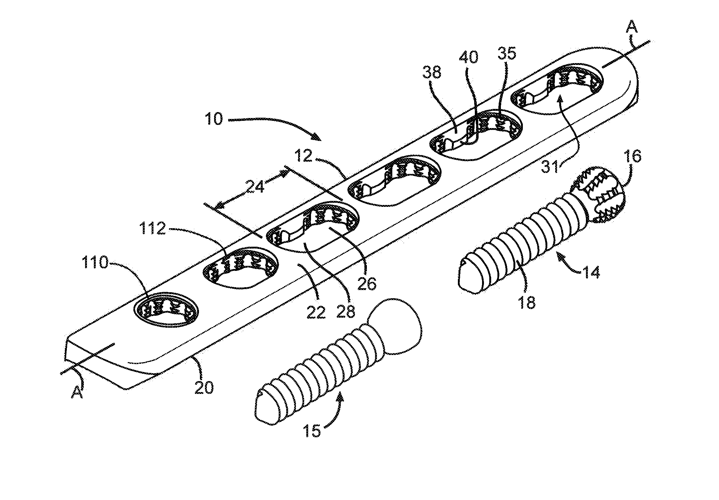 Bone Plate Assembly