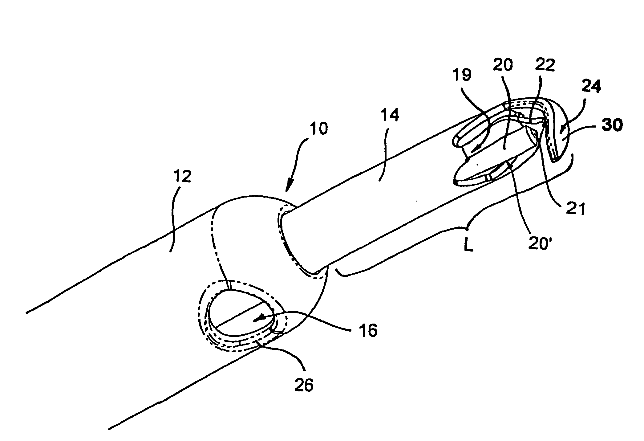 Device and methods useable for treatment of glaucoma and other surgical procedures