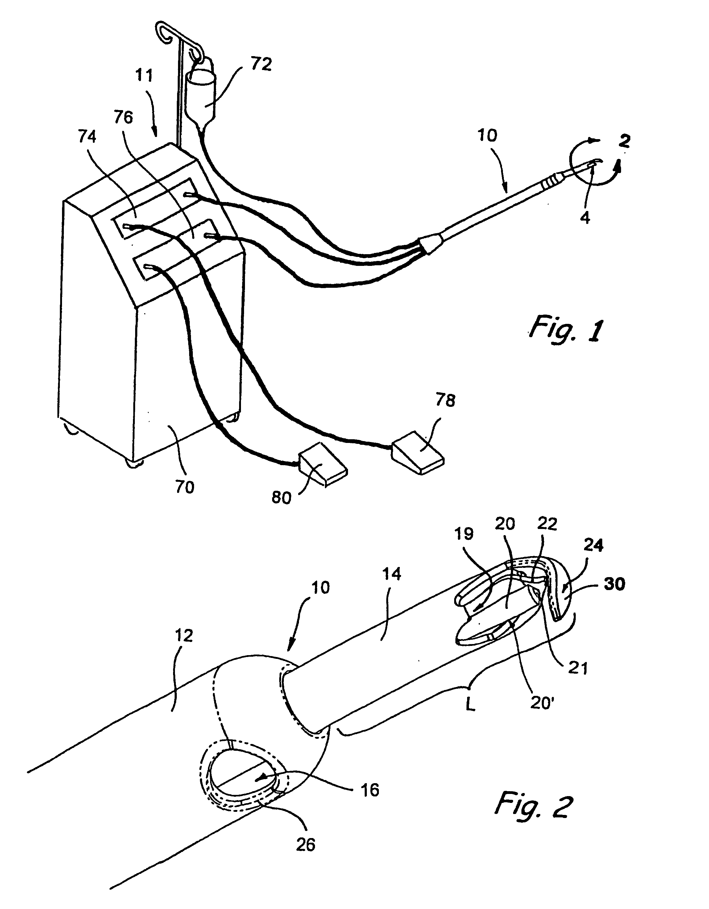 Device and methods useable for treatment of glaucoma and other surgical procedures