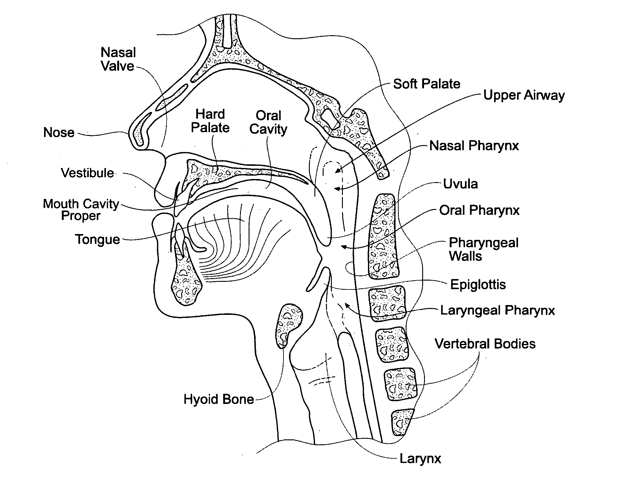 Devices, systems and methods using magnetic force systems in the tongue