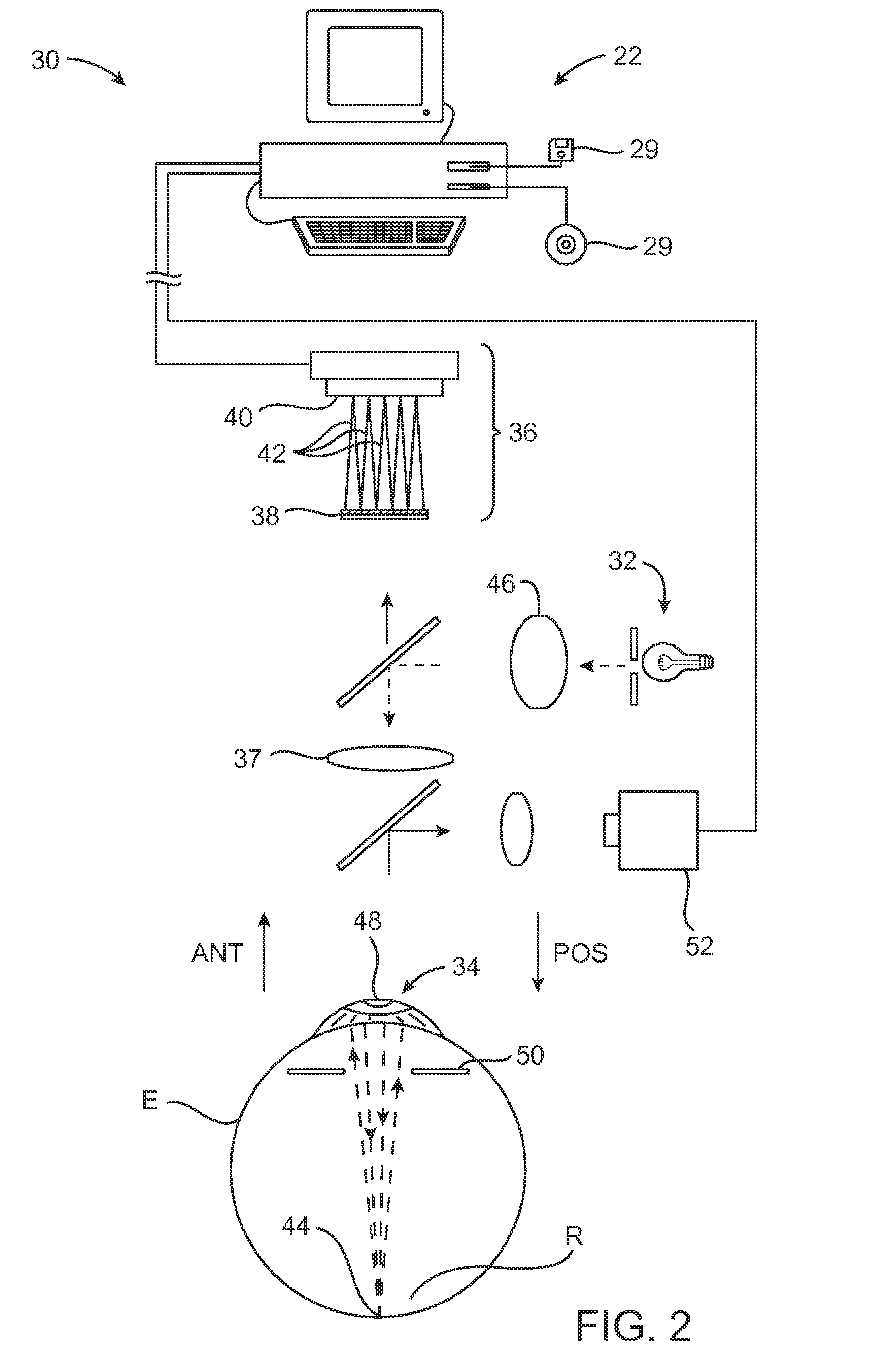 Closed Loop System and Method for Ablating Lenses with Aberrations