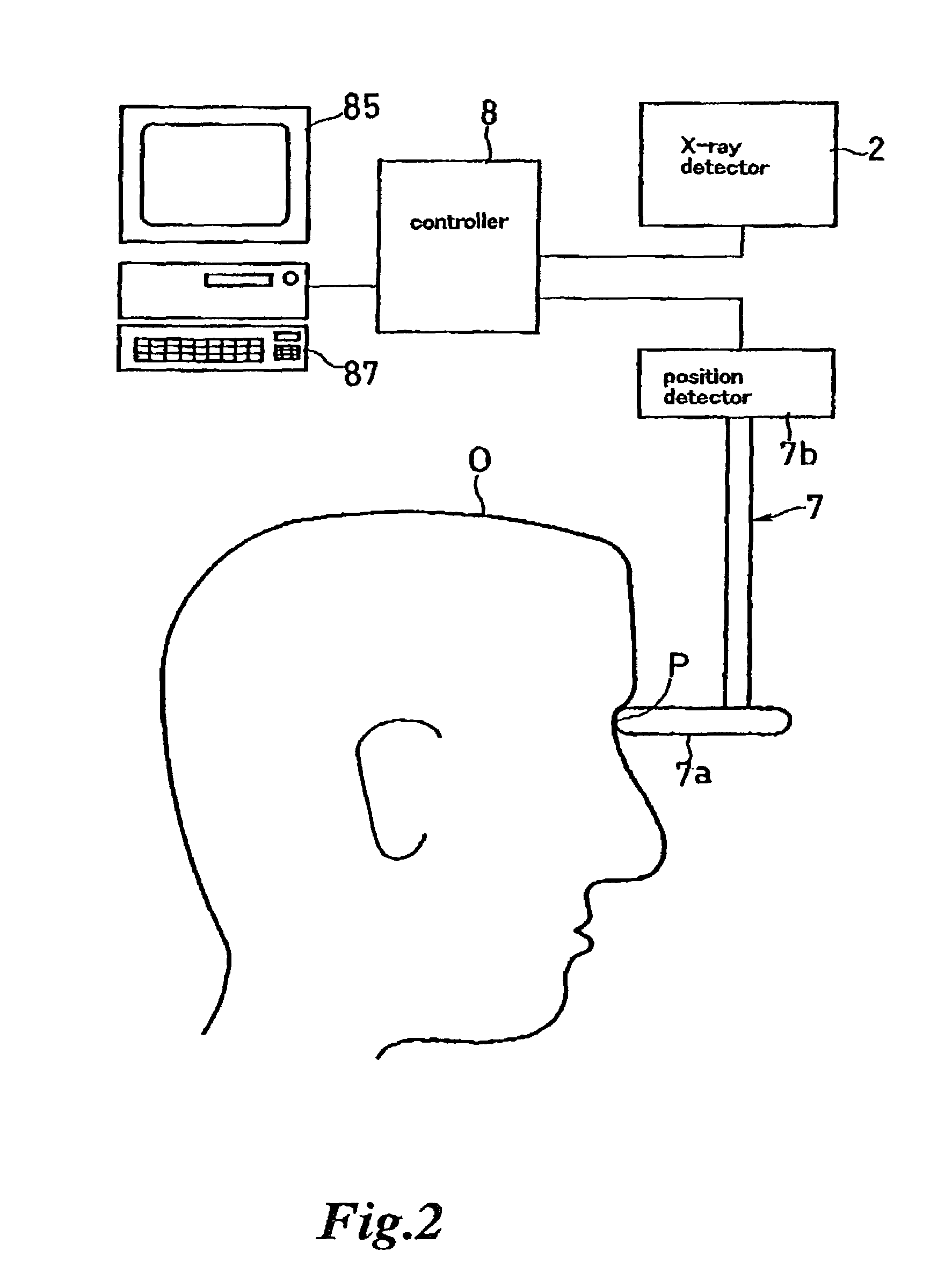 Scan type digital X-ray imaging apparatus