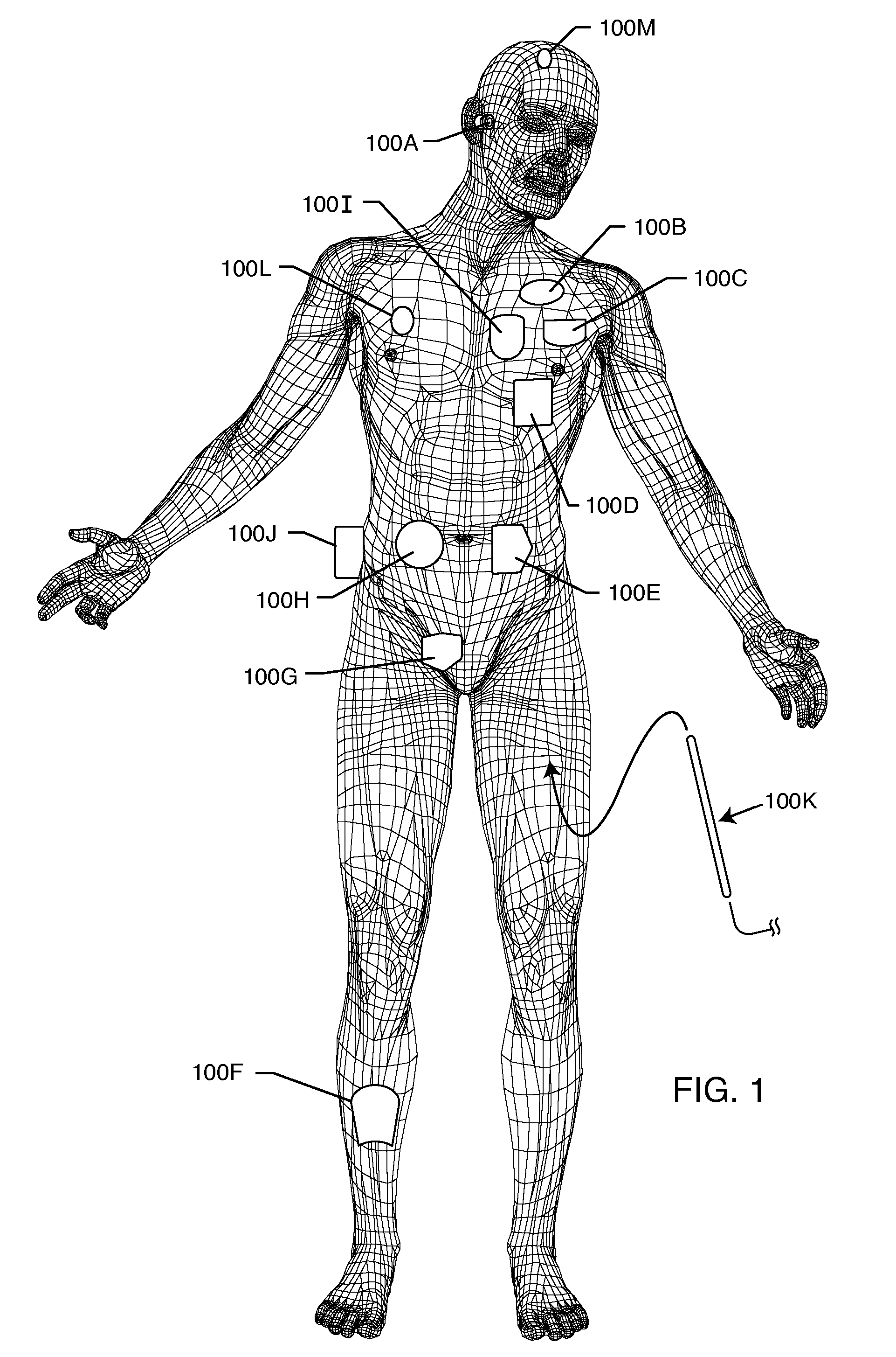 Tank filters placed in series with the lead wires or circuits of active medical devices to enhance MRI compatibility