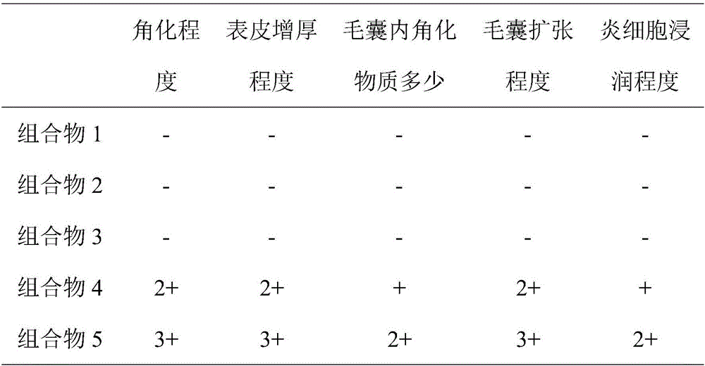 Composition for treating acne and use thereof