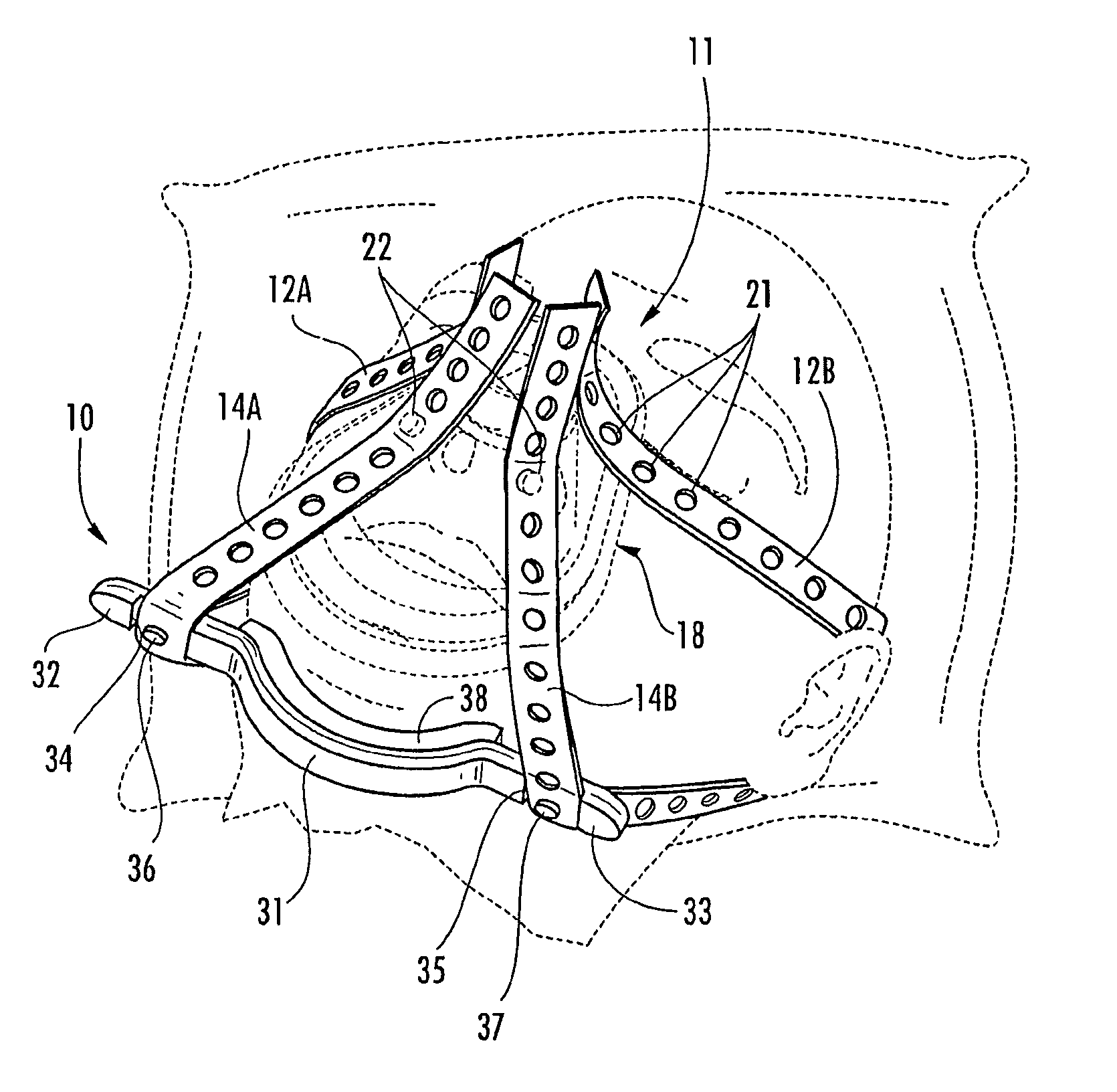 Ergonomic chin support for medical headgear