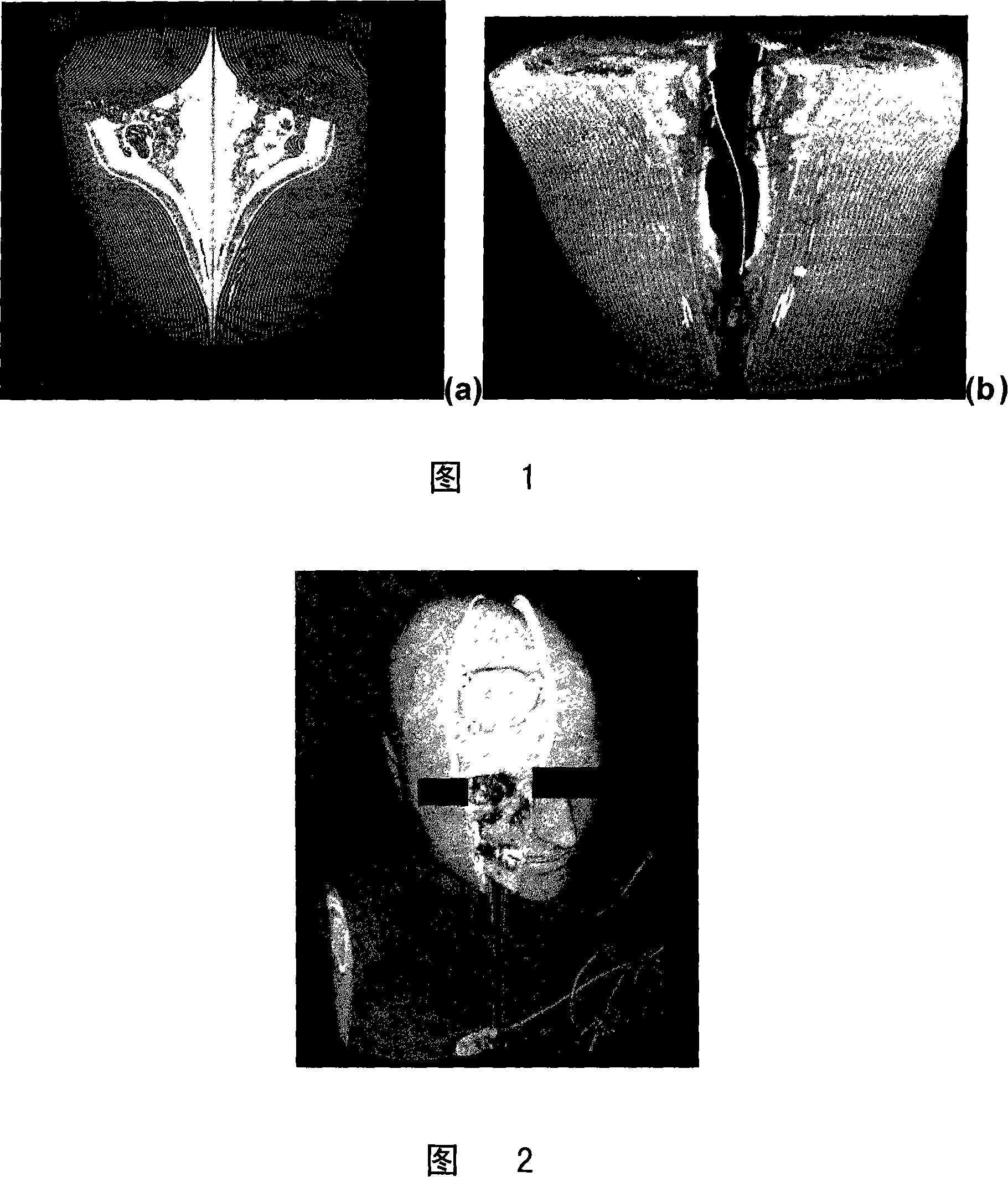 System and method for in-context volume visualization using virtual incision