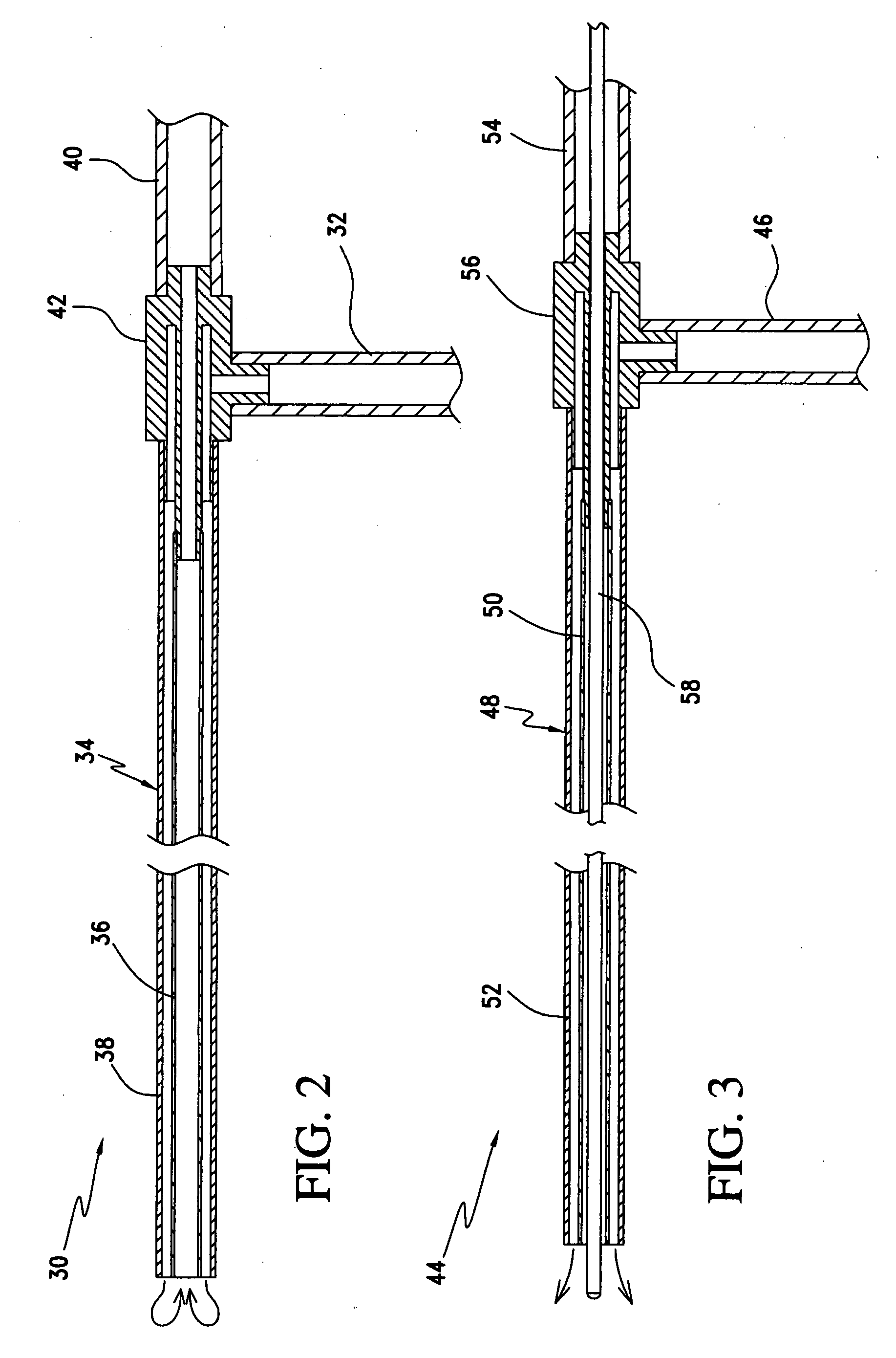 Open system heat exchange catheters and methods of use