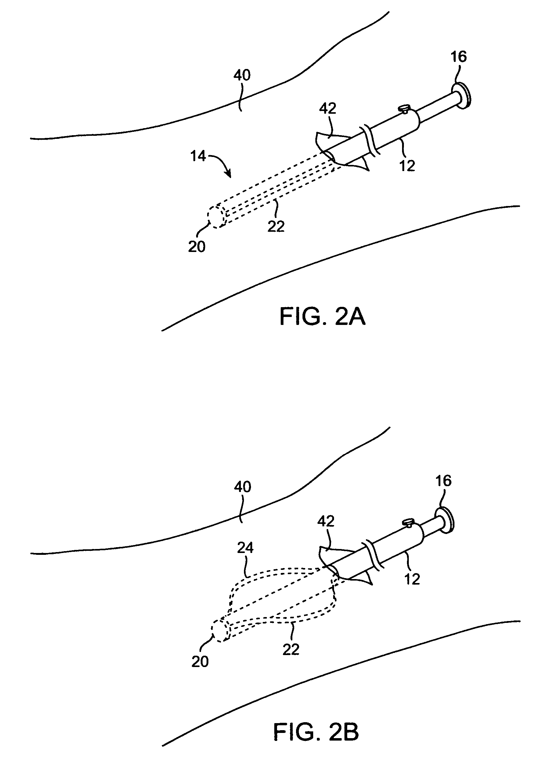 System for tissue dissection and retraction