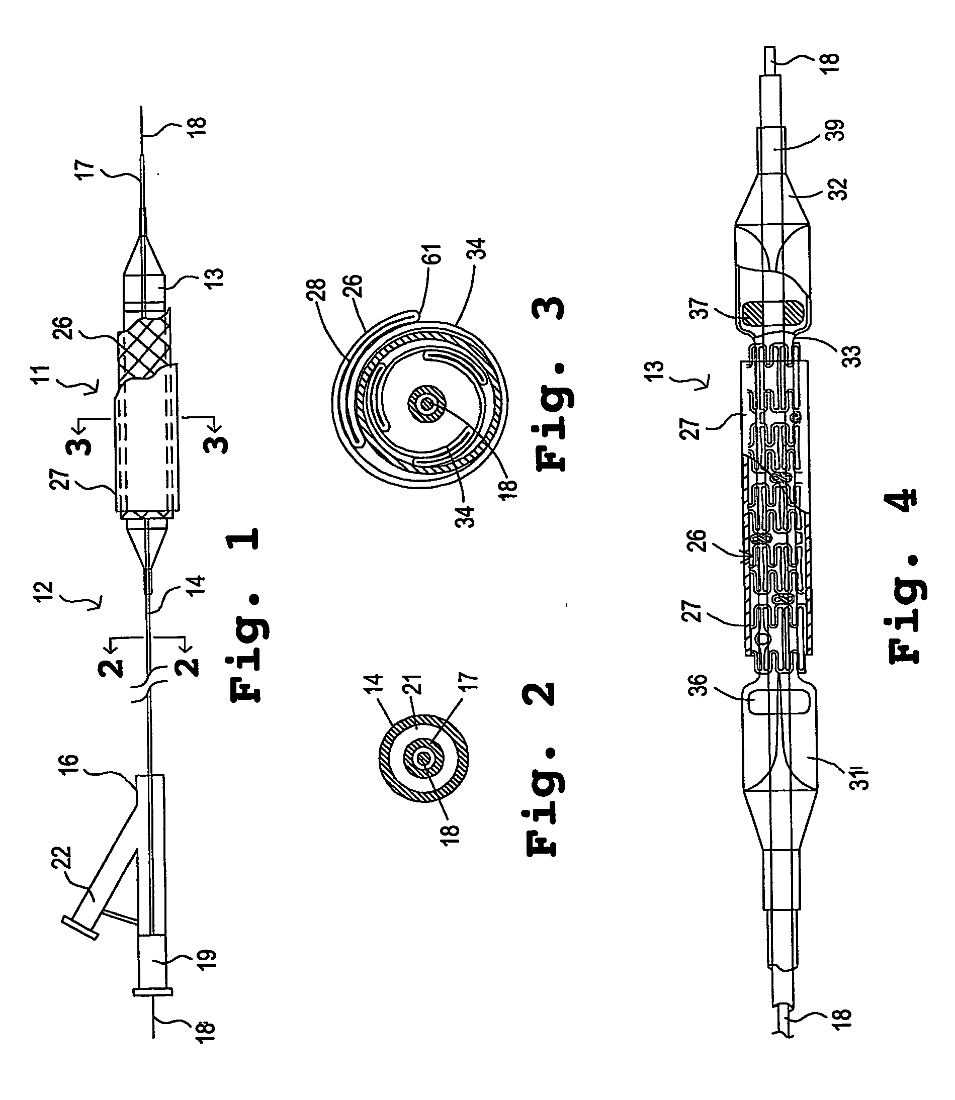 Composite stent with polymeric covering and bioactive coating