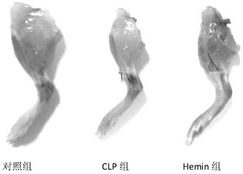 Application of hemin in preparation of drugs used for preventing and treating muscle atrophy caused by sepsis