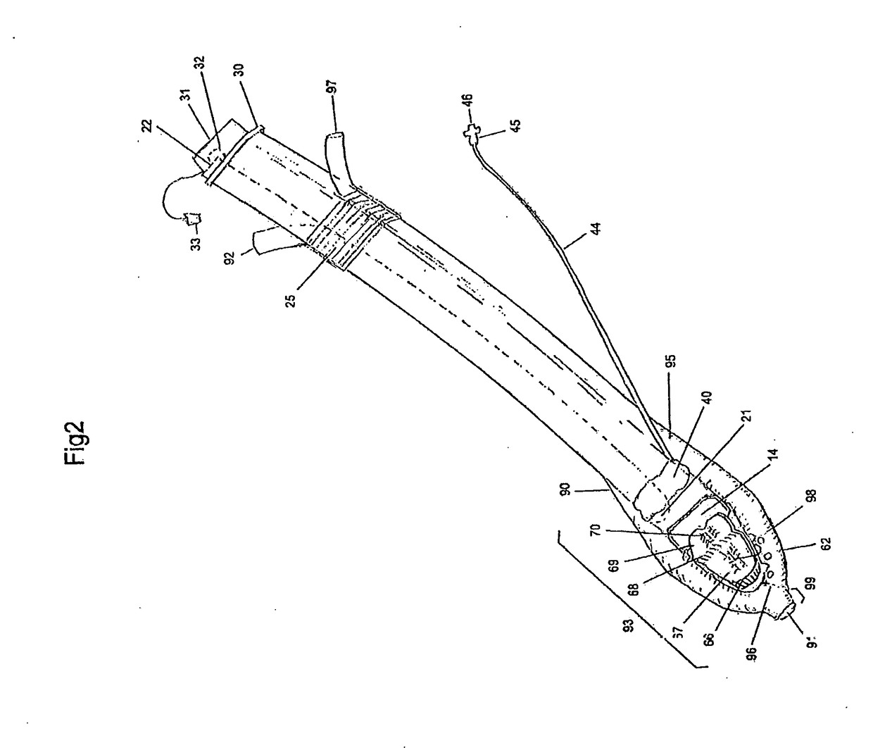 Endotracheal Intubation and Supraglottic Airway Device