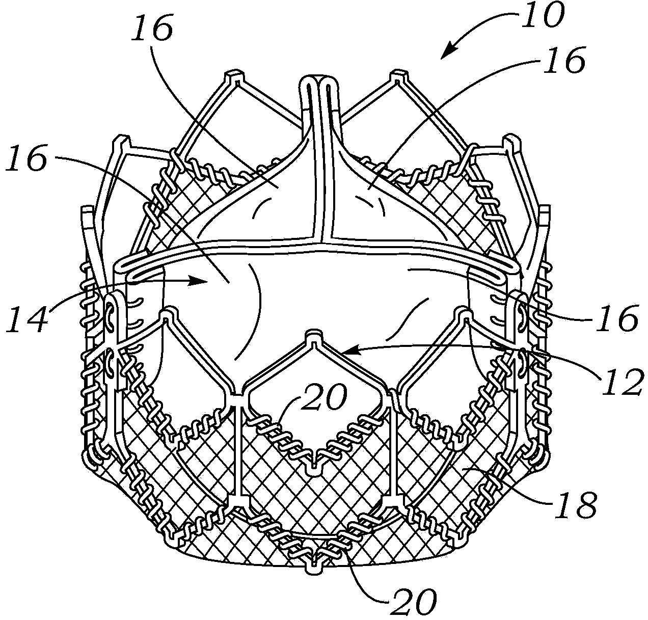 Encapsulated heart valve