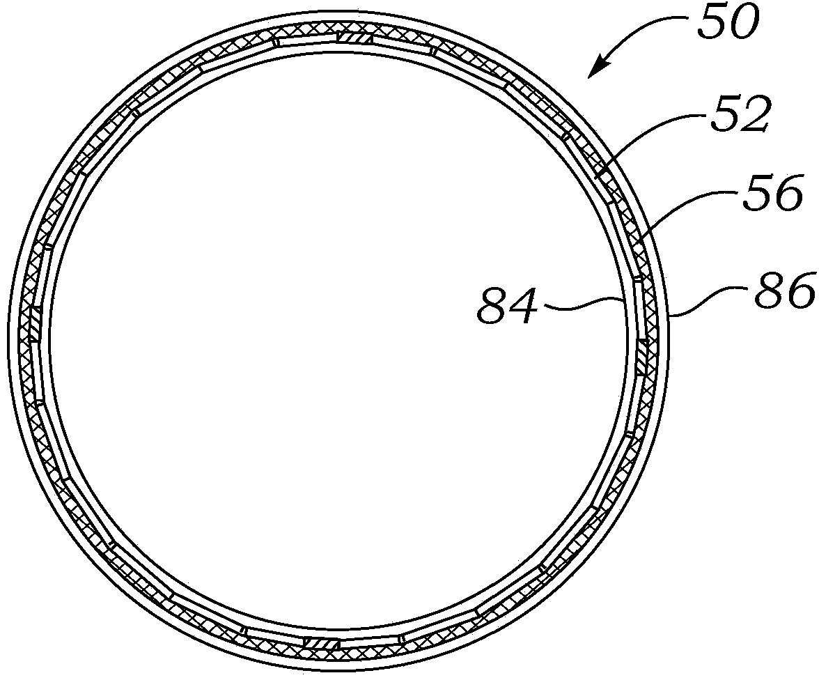 Encapsulated heart valve