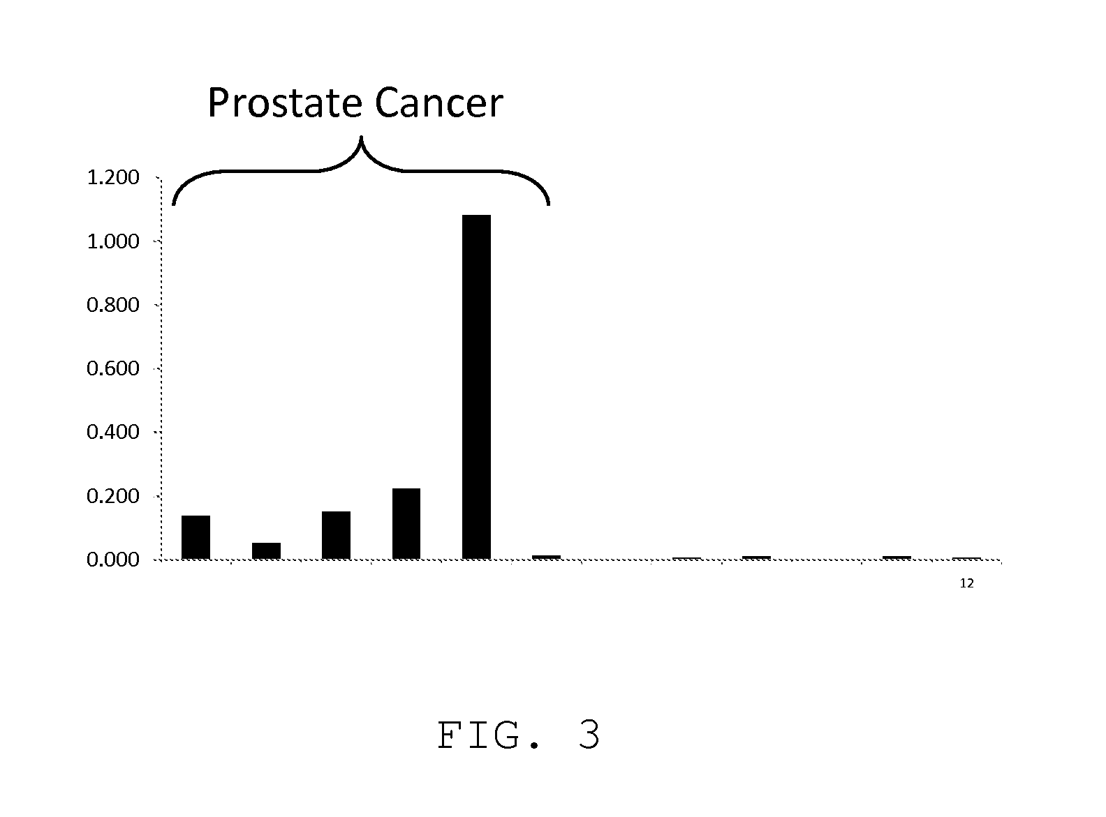 Measurement of PKA for cancer detection