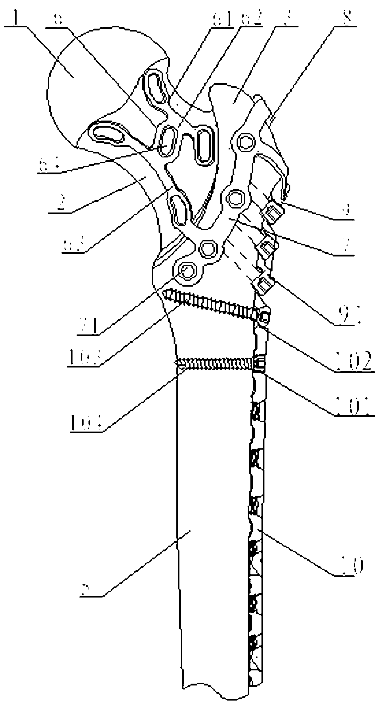 Combined implanting system for minimally invasive thigh bone