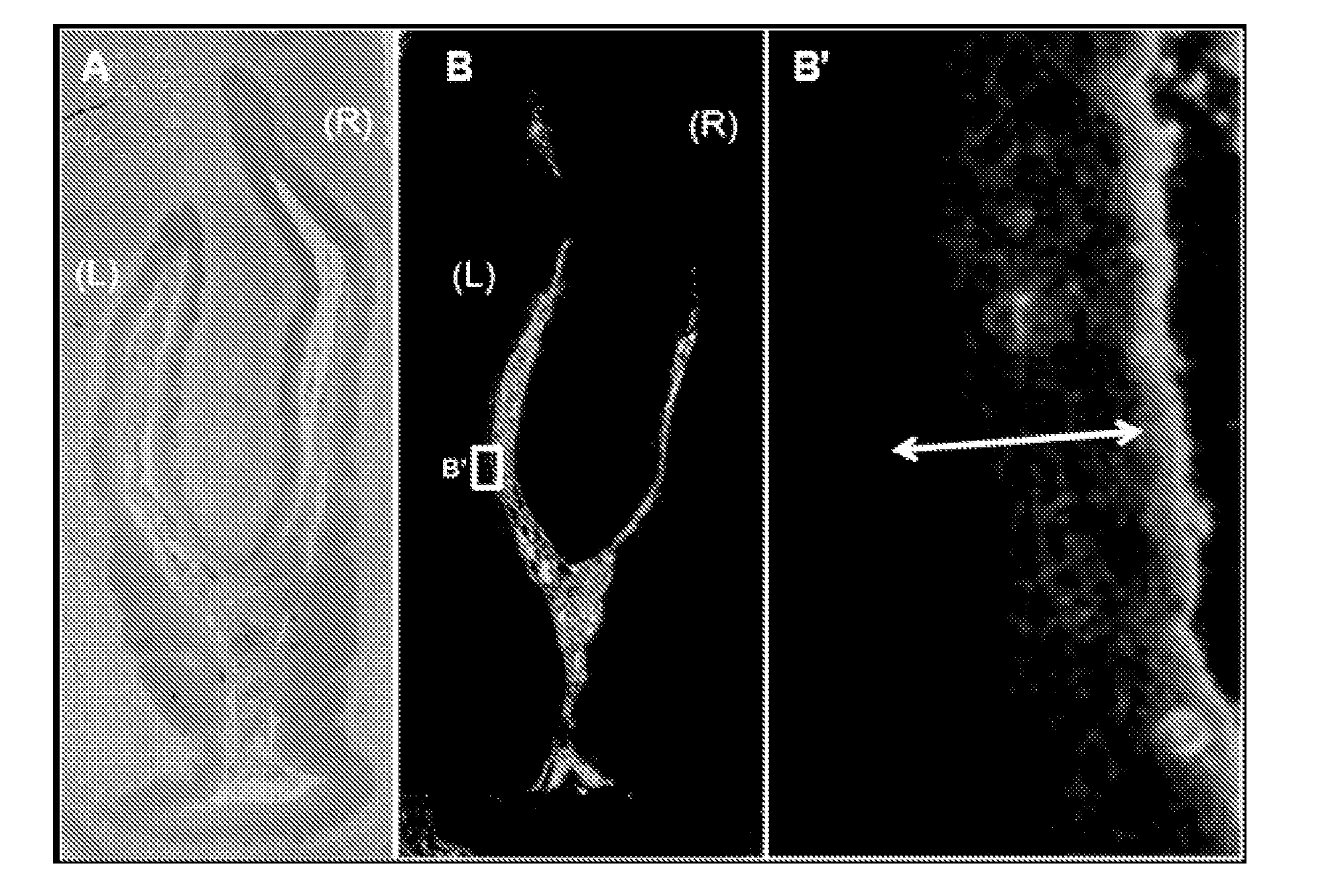 Thermo-sensitive, mucoadhesive or dermoadhesive, and penetration-enhancing formulations for topical delivery of therapeutics