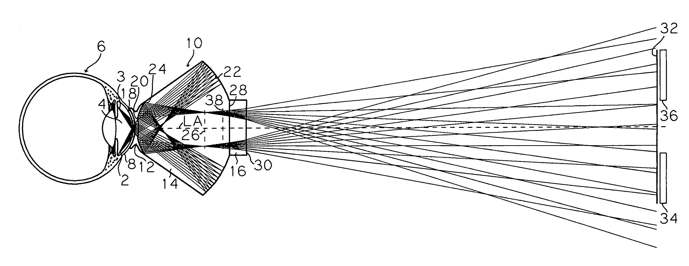 Real image forming eye examination lens utilizing two reflecting surfaces providing upright image