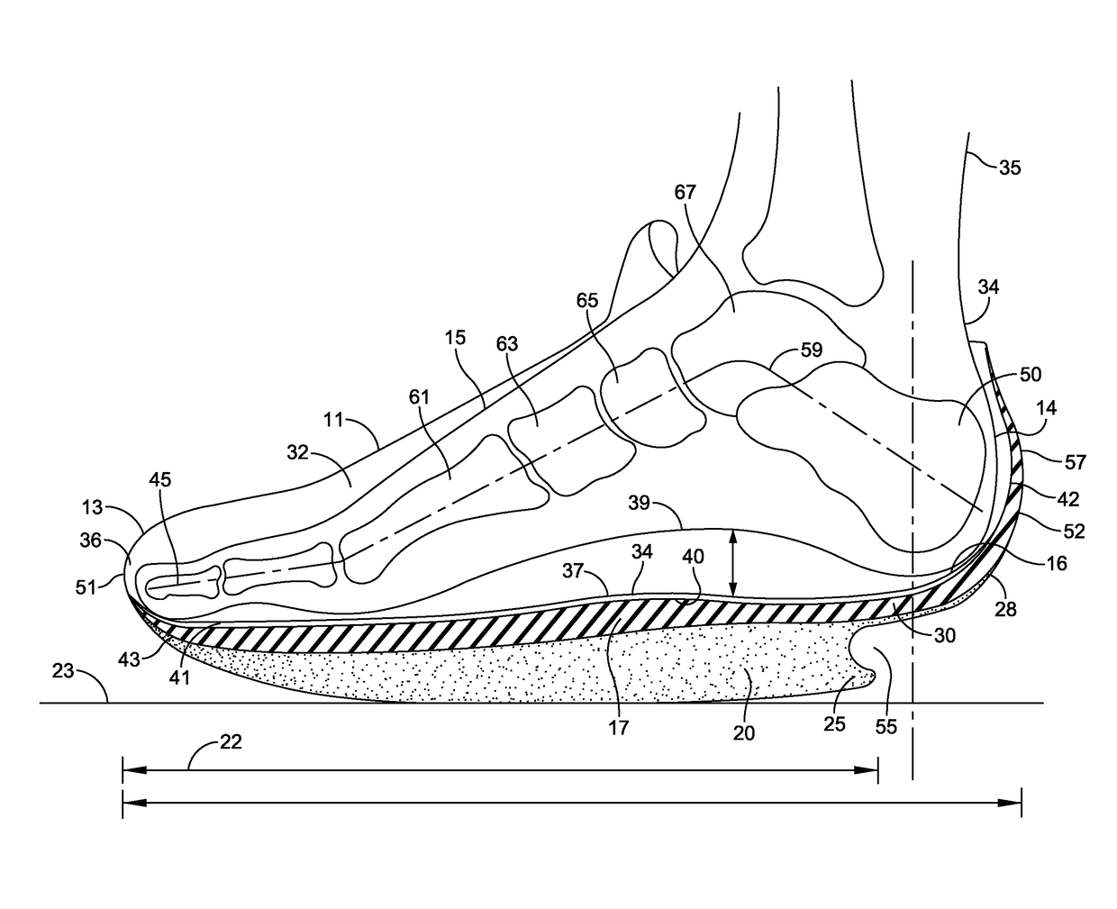 Heelless athletic shoe